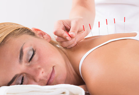Acupuncture for pain relief in Elkins Park